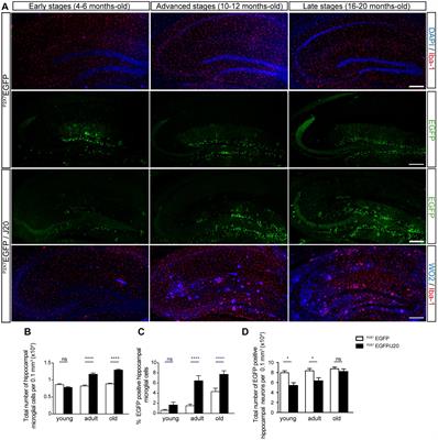 Amyloid Peptide Induced Neuroinflammation Increases the P2X7 Receptor Expression in Microglial Cells, Impacting on Its Functionality